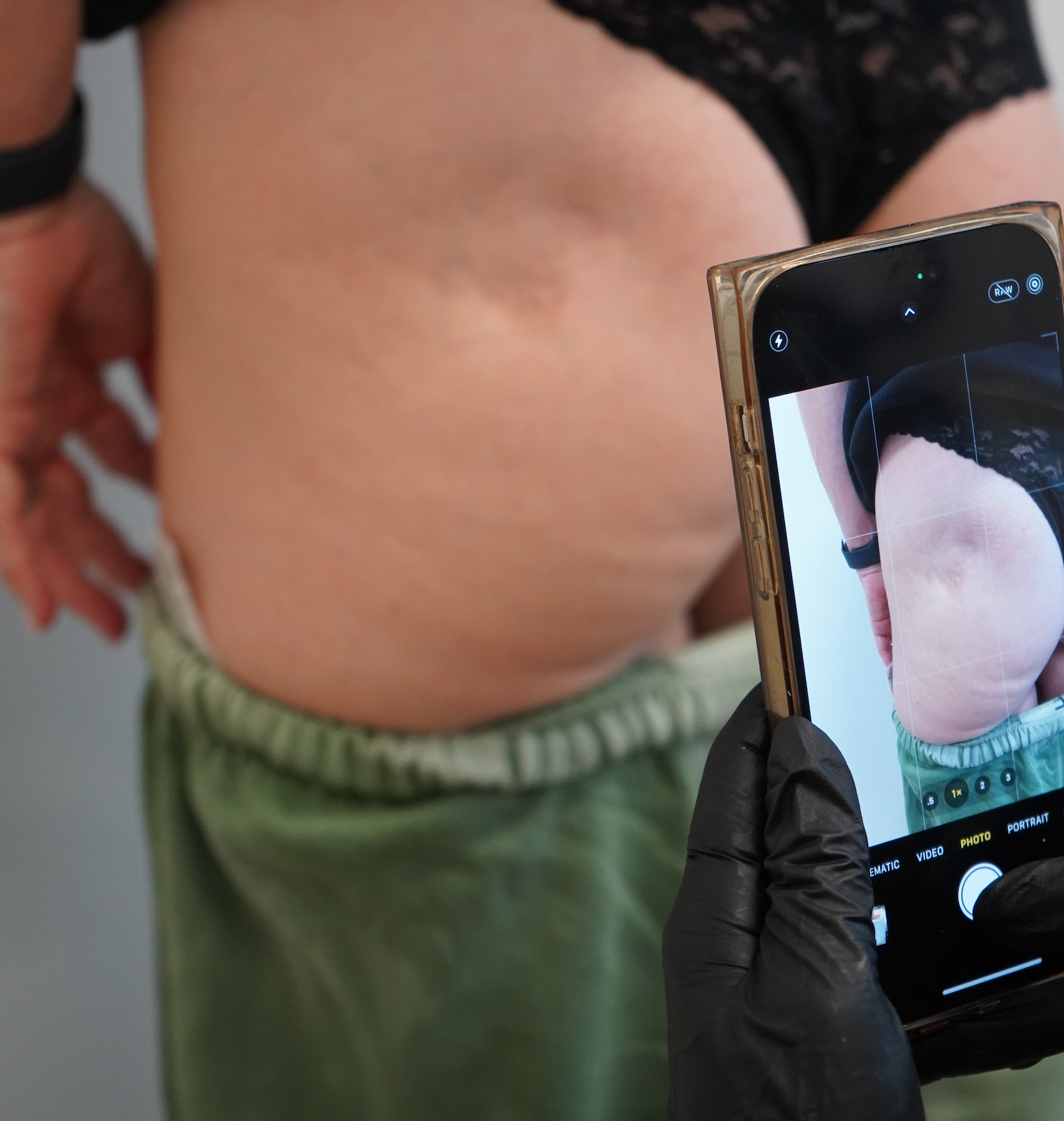 IN THE PRESS-Misleading Before and After Photos: What to Look Out for in the Aesthetics Industry-Revay Aesthetics-Best-Injector-Central-Valley-Fresno-California