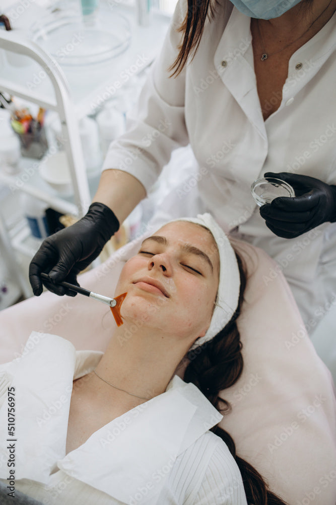 a photo of a patient receiving a chemical peel treatment to her face