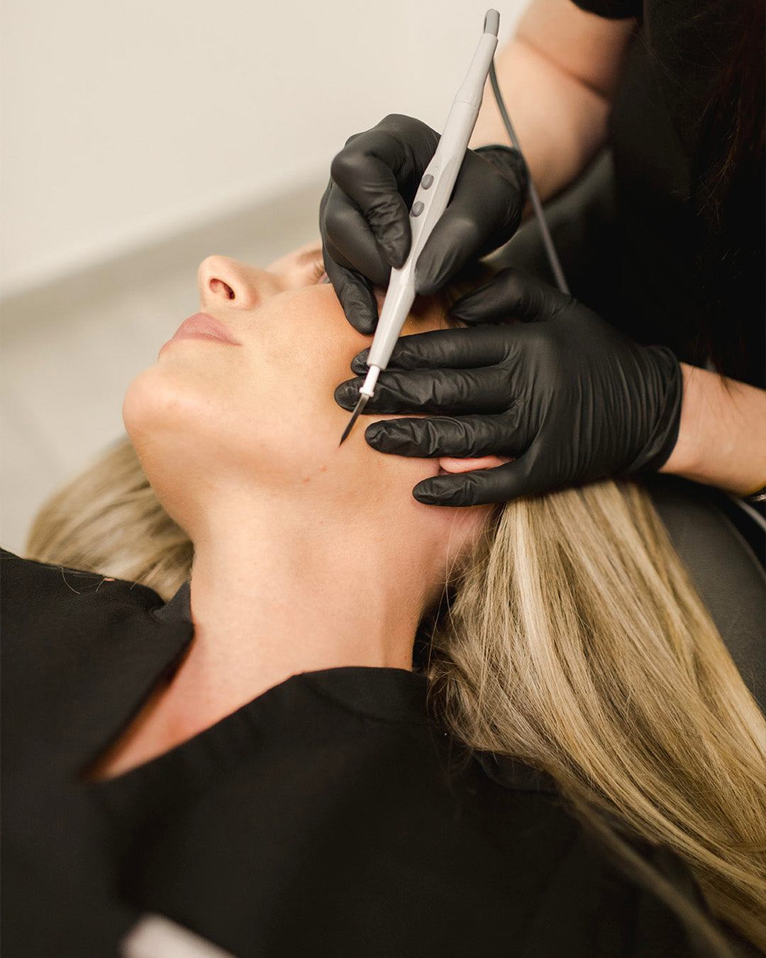 woman receiving hyfrecation to face from Revay Aesthetics