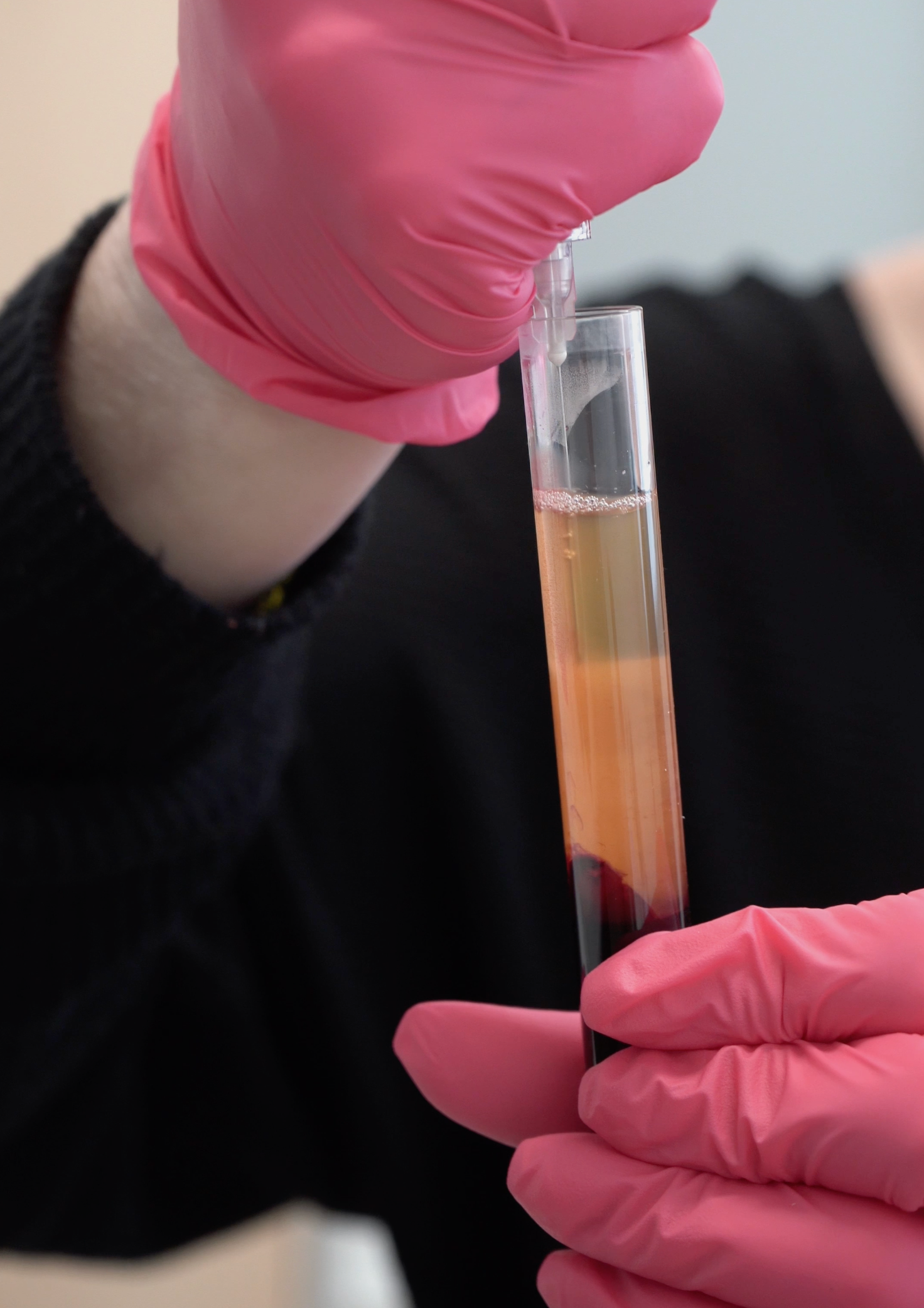 close up of natural growth factors being extracted with a needle