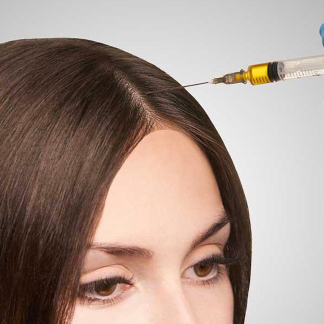 a woman receiving prp injections to her scalp for hair loss