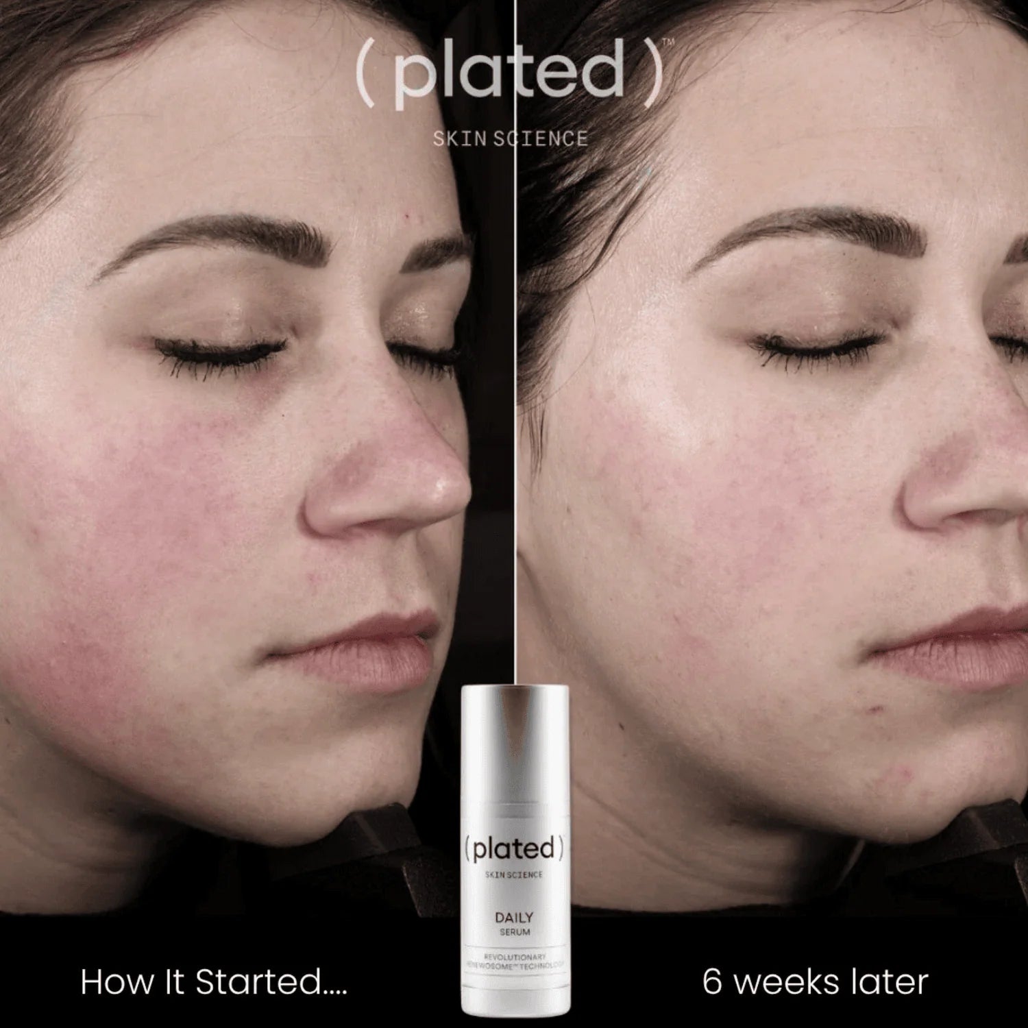 Before and after comparison of a woman's face with (plated) DAILY Serum product.
