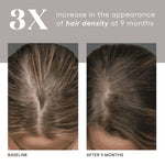 Before and after using plated hair serum showing increased hair density at the part after 9 months