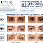 UPNEEQ EYE OPENING DROPS (DISCLAIMER)-Eye Care-Upneeq-Revay Aesthetics