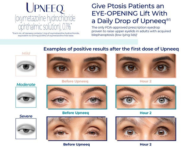 UPNEEQ EYE OPENING DROPS (DISCLAIMER)-Eye Care-Upneeq-Revay Aesthetics