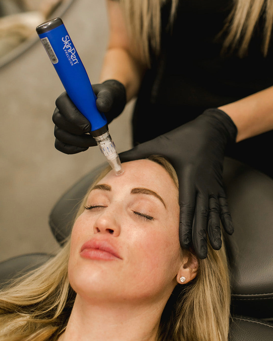 woman receiving microneedling treatment to forehead