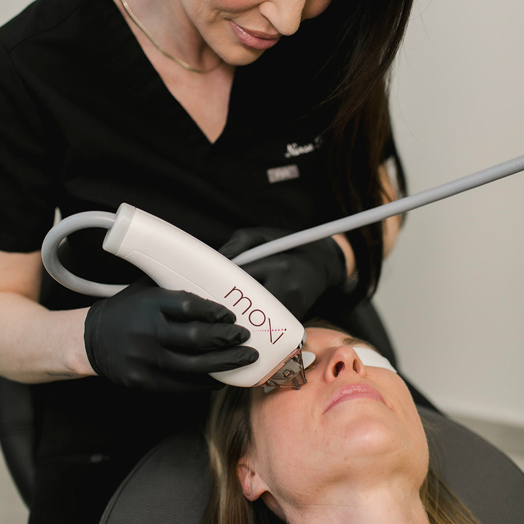 woman receiving moxi laser treatment from Revay Aesthetics