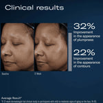 Before and after facial comparison with clinical improvement statistics on a blue background