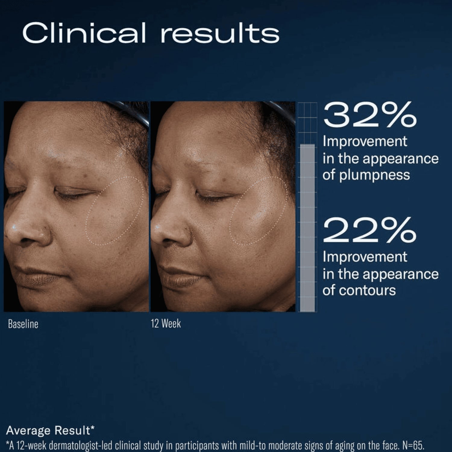 Before and after facial comparison with clinical improvement statistics on a blue background